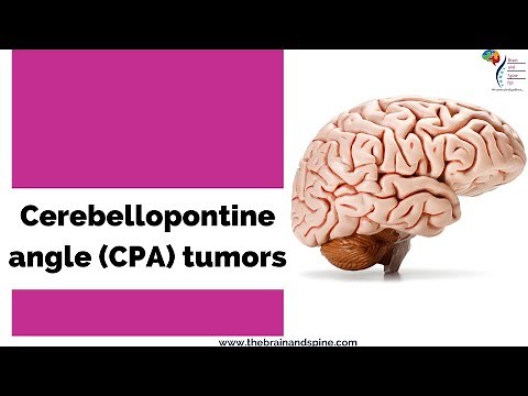 Cerebellopontine angle (CPA) tumors - An Overview | Best Spine Surgeon| Dr Manish Vaish
