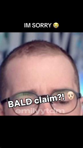 La Calvicie de DanTDM: ¡Una Verdadera Conversación!