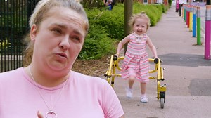 96K views · 2.6K reactions | Desde su nacimiento, esta pequeña de cuatro años fue diagnosticada con el síndrome de "Benjamín Button" una condición que provoca su envejecimiento acelerado. Ahora, sus padres buscan que ella se transforme en una inspiración para todos aquellos con alguna discapacidad六‍⚕⌛ #SoyExtraordinario | Discovery Latinoamérica | Facebook