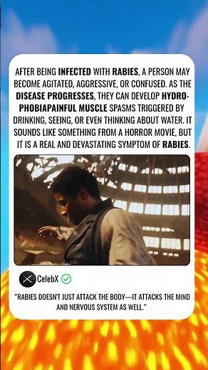 How Rabies Turns You Into a Completely Different Person #medical #facts #shorts