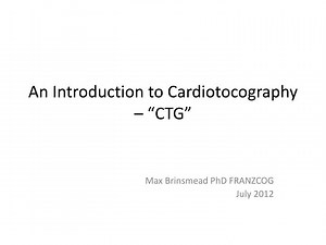 An Introduction to Cardiotocography – “CTG” - SlideServe