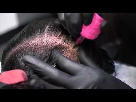 Scalp Micropigmentation for women to add density!