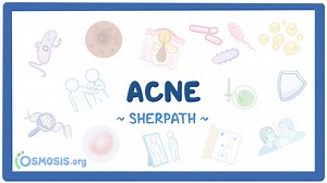 Acne: Video, Causes, & Meaning | Osmosis