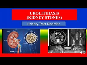 UROLITHIASIS (KIDNEY STONES) - Definition, types, causes, pathophysiology, diagnoses , medicine