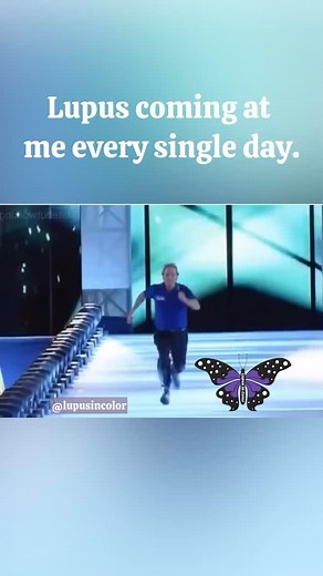 1K reactions · 29 comments | Every day it never fails! 臘‍♀️#lupusincolor | Lupus In Color | Facebook