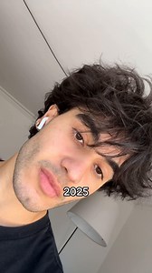 Anti-Aging Hair Transformation: Hair Loss Treatment Journey