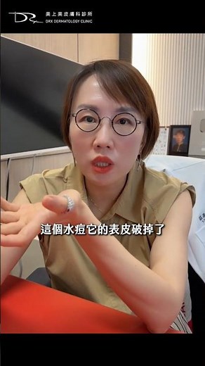 想治水痘疤？這件事一定要先想清楚 #水痘疤 #水痘 #帶狀皰疹病毒 #真皮層 #真皮移植 #磨皮雷射
