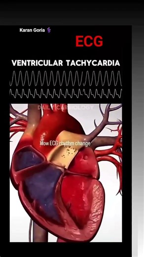 Understanding ECG ChangesLearning to interpret ECGs is a vital skill for every healthcare provider