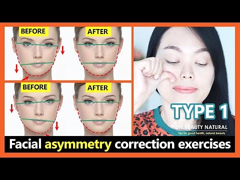 (Type 1) How to fix asymmetrical face, get a symmetrical face naturally. Facial asymmetry exercises.