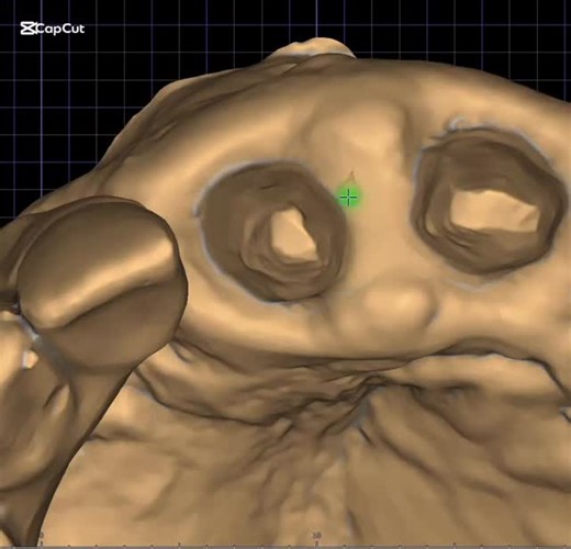 Bakr ibrahim | #dentaltechnician #exocad #dentist #explor #dentalassistant | Instagram