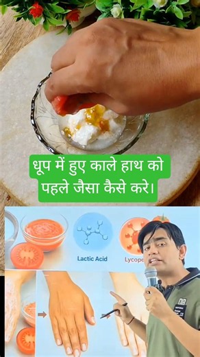 ✨ Sun Tan Gone! Try This Natural Paste | Vedant Sir Skin care #shorts #skincare