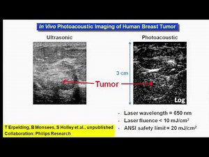 Lihong Wang presentation: Ultrasonically Beating Optical Diffusion and Diffraction