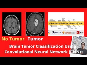 Brain Tumor Classification Using Convolutional Neural Network (CNN) - Training Accuracy