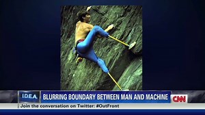 Double amputee leads the bionic age