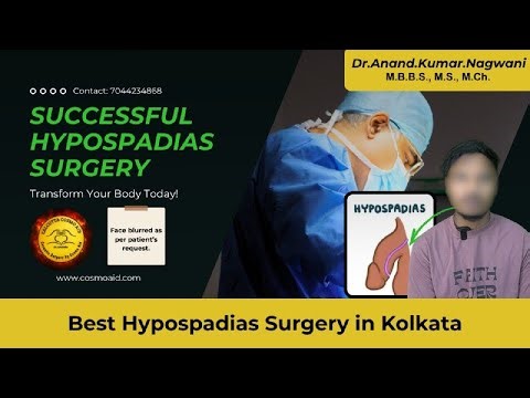 Successful Hypospadias Surgery in Kolkata | Best Hypospadias Clinic in India| Cosmo aid