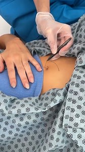 637K views · 2.2K reactions | world's longest single hair pulled out nurse pulls long hair out of belly button This original video was produced by Rick Lax Productions, Anna Rothfuss. | American Short Film Depot | Facebook