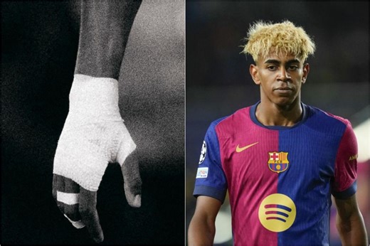 ¿Recado de Lamine a los que dudan de los vendajes del Barcelona?