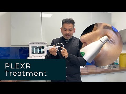 PLEXR Treatment: Everything You Need To Know | Dr Dev Patel