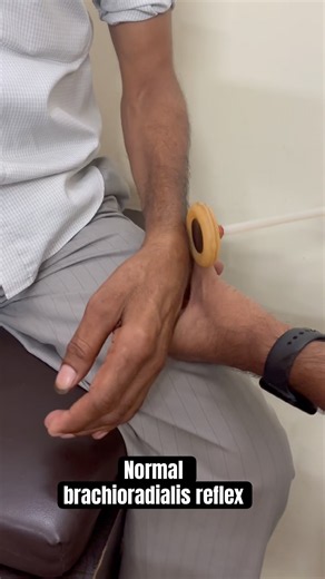 Inverted Triceps Reflex