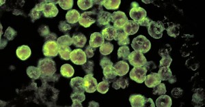 Florida man dies from brain-eating amoeba, possibly from nose rinse with tap water