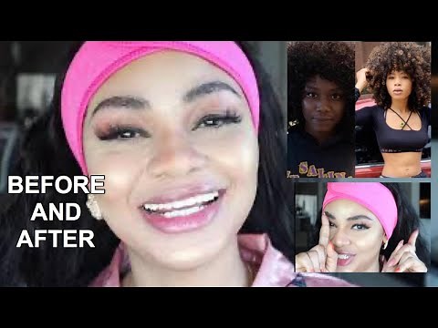SKIN BLEACHING - BEFORE & AFTER OF SKIN WHITENING AND THE PRODUCTS USED.