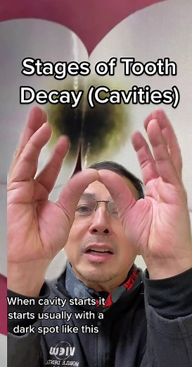 Preventing Tooth Decay: Dental Care Tips for Healthy Teeth