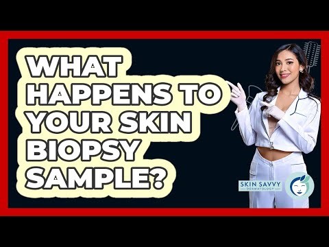 What Happens To Your Skin Biopsy Sample? - Skin Savvy Dermatology