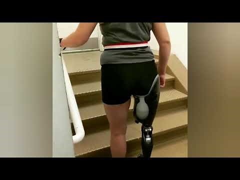 Amputee Dak walking with prosthesis
