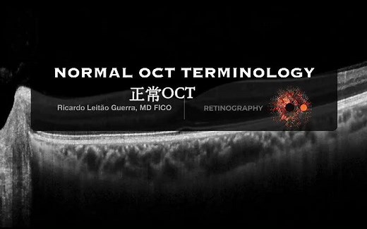 正常OCT
