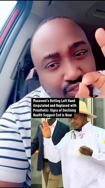 Museveni's Health Decline: Amputation and Prosthetic Update