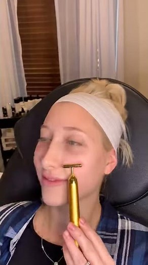Under eye correction with Belotero Balance filler