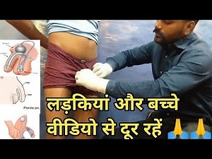 Army Medical Test में Private part कैसे check किए जाते हैं। लड़की और बच्चे वीडियो से दूर रहें 🙏🙏