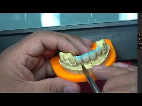 TECNICA CUT-BACK, E.MAX PRESS, E.MAX CERAM