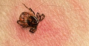 Here's what you need to know about tick season