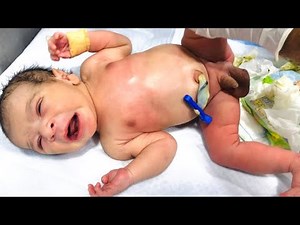 How to Change Diaper of a Premature Baby 👶 | Soft and Safe Cleaning in NICU 💧 #BabyCare #NICULife