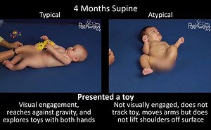 12K views · 78 reactions | Are you tracking baby's motor development...