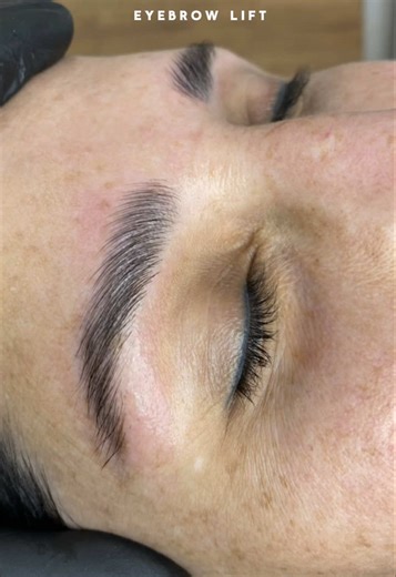 הרמת גבות עם מיקרובליידינג - תוצאה מדהימה!