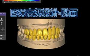 EXO高级设计-贴面