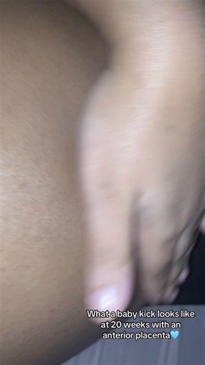 Understanding Baby Kicks at 20 Weeks of Pregnancy