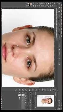 How to Fix Acne in Photoshop & Camera Raw (Texture Saving Method)