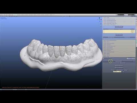 How to make a Denture rebase or reline!