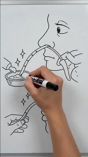How to Insert a Nasogastric Tube Safely | Step-by-Step Guide