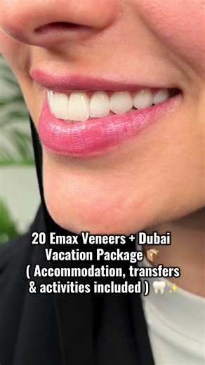 Transform Your Smile with 20 Emax Veneers in Dubai