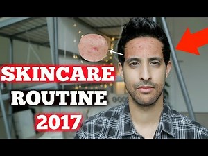 REMOVE PIMPLES in 6 easy steps! | Sami Slimani