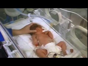 Surfactant Administration