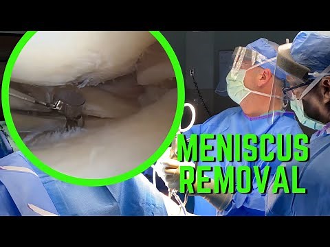 Meniscus Removal Surgery
