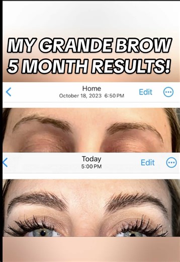 Transform Your Eyebrows with Grande Brow After 5 Months