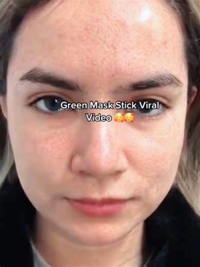 Solusyon sa Malalaking Pores gamit ang Green Mask Stick