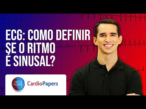 ECG Sinus Rhythm: learn how to identify it on the electrocardiogram