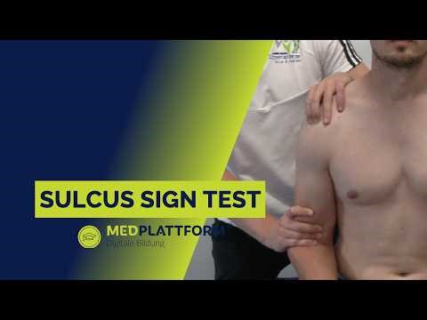Sulcus Sign - Schulter